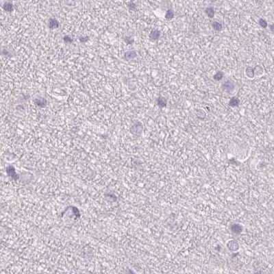 Immunohistochemistry-Paraffin: 17 beta-HSD1/HSD17B1 Antibody [NBP2-39053] - Staining of human cerebral cortex.