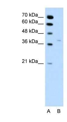 Western Blot: 17 beta-HSD1/HSD17B1 Antibody [NBP1-56295] - Jurkat cell lysate, Antibody Titration: 0.2-1 ug/ml