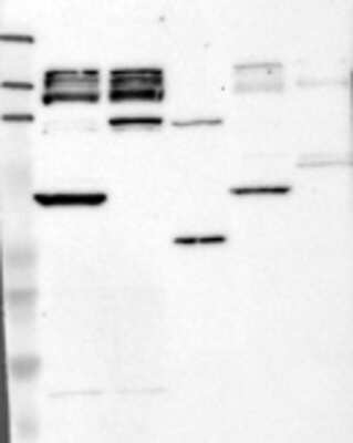 Western Blot: TSP50 Antibody [17190002] - Samples: Lane 1, Marker [kDa]: 219, 111, 83, 48, 32, 26, 17  Lane 2, RT-4  Lane 3, U-251MG sp  Lane 4, Human Plasma  Lane 5, Liver  Lane 6, Tonsil,  Target weight [kDa]:   43   Validation score:   2   Validation description:  Supportive - Band of predicted size in kDa (+/-20%) with additional bands present.