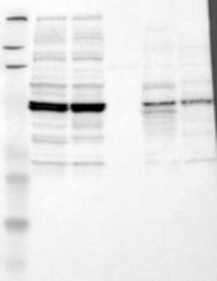 Western Blot: CXCR4 Antibody [19490002] - Samples:  Lane 1, Marker [kDa]: 219, 111, 83, 48, 32, 26, 17  Lane 2, RT-4  Lane 3, U-251MG sp  Lane 4, Human Plasma  Lane 5, Liver  Lane 6, Tonsil ,   Target weight [kDa]:  40   Validation score:  2   Validation description:  Supportive - Band of predicted size in kDa (+/-20%) with additional bands present.