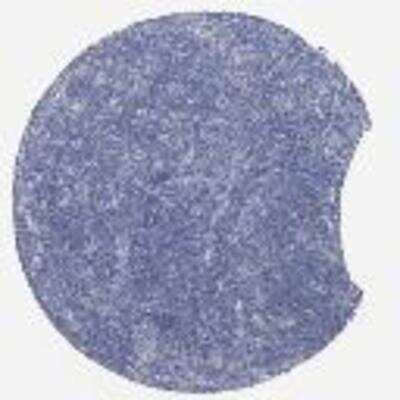 Immunohistochemistry: Opsin 3 Antibody [20770002] - Most normal tissues displayed moderate cytoplasmic positivity. Most malignant lymphomas, gliomas and lung cancers were negative. Image (malignant lymphoma) was provided courtesy of the Swedish Human Proteome Resource (HPR) Center.