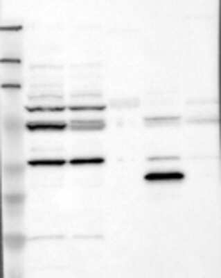 Western Blot: Opsin 3 Antibody [20770002] - Samples:  Lane 1, Marker [kDa]: 213, 118, 83, 50, 33, 26, 18  Lane 2, RT-4 Lane 3, U-251MG sp  Lane 4, Human Plasma  Lane 5, Liver  Lane 6, Tonsil ,  Target weight [kDa]:   45, 36 (splice variants)   Validation score: 2 Validation description:   Supportive - Band of predicted size in kDa (+/-20%) with additional bands present.
