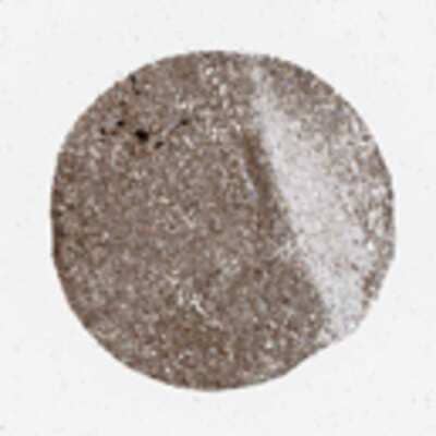 Immunohistochemistry: ROPN1 Antibody [21050002] - Normal tissues showed moderate to strong cytoplasmic staining. Additional membranous positivity was sometimes seen. Testis, gastro-intestinal tract, parathyroid gland, placenta, spleen and myocytes displayed strong cytoplasmic immunoreactivity. A majority of cancers displayed moderate cytoplasmic staining. Colo-rectal, renal, stomach and liver malignancies exhibited moderate to strong positivity. Gliomas, lymphomas, melanomas, skin and lung cancers were weakly to moderately stained.  Image and statement courtesy of the Human Protein Atlas (HPA).