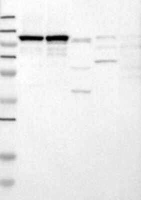 Western Blot: RBM15 Antibody [21390002] - Samples: Lane 1: Marker [kDa]: 250, 130, 95, 72, 55, 36, 28, 17, 11 / Lane 2: RT-4 / Lane 3: U-251MG sp / Lane 4: Human Plasma / Lane 5: Liver / Lane 6: Tonsil;  Target weight [kDa]: 107, 106, 3 (splice variants)