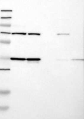 Western Blot: DDHD2 Antibody [21400002] -  Samples:  Lane 1, Marker [kDa]: 250, 130, 95, 72, 55, 36, 28, 17, 11  Lane 2, RT-4  Lane 3, U-251MG sp  Lane 4, Human Plasma  Lane 5, Liver  Lane 6, Tonsil ,  Target weight [kDa]:  81, 44 (splice variants)    Validation score:  2   Validation description:  Supportive - Band of predicted size in kDa (+/-20%) with additional bands present. 