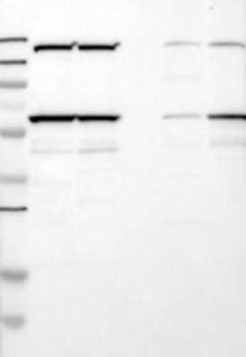 Western Blot: N-PAC Antibody [21580002] - Samples:  Lane 1, Marker [kDa]: 250, 130, 95, 72, 55, 36, 28, 17, 11  Lane 2, RT-4  Lane 3, U-251MG sp  Lane 4, Human Plasma  Lane 5, Liver  Lane 6, Tonsil ,  Target weight [kDa]:   61, 59 (splice variants)   Validation score:   2   Validation description:  Supportive - Band of predicted size in kDa (+/-20%) with additional bands present.