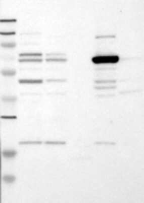 Western Blot: PCK1 Antibody [21660002] - Samples:  Lane 1, Marker [kDa]: 250, 130, 95, 72, 55, 36, 28, 17, 11  Lane 2, RT-4  Lane 3, U-251MG sp  Lane 4, Human Plasma  Lane 5, Liver  Lane 6, Tonsil ,   Target weight [kDa]:  69    Validation score:  2   Validation description:   Supportive - Band of predicted size in kDa (+/-20%) with additional bands present.