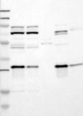 Western Blot: PROSC Antibody [21730002] - Samples: Lane 1, Marker [kDa]: 250, 130, 95, 72, 55, 36, 28, 17, 11  Lane 2, RT-4  Lane 3, U-251MG sp  Lane 4, Human Plasma  Lane 5, Liver  Lane 6, Tonsil , Target weight [kDa]:  30   Validation score:  2   Validation description:   Supportive - Band of predicted size in kDa (+/-20%) with additional bands present. 