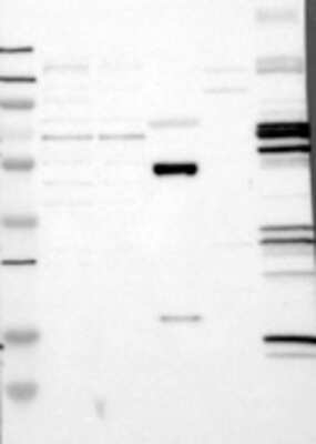 Western Blot: DCLK3 Antibody [21890002] - Samples:  Lane 1, Marker [kDa]: 250, 130, 95, 72, 55, 36, 28, 17, 11  Lane 2, RT-4 Lane 3, U-251MG sp  Lane 4, Human Plasma  Lane 5, Liver  Lane 6, Tonsil , Target weight [kDa]:  74   Validation score:  2   Validation description:  Supportive - Band of predicted size in kDa (+/-20%) with additional bands present.
