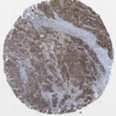 Immunohistochemistry: CC2D1A Antibody [22310002] - Most of the normal tissues displayed moderate cytoplasmic immunoreactivity. Nucleolar positivity was observed in neuronal, lymphoid and renal cells. Strong cytoplasmic staining was observed in glandular cells of gastro-intestinal tract whereas neuronal cells of CNS revealed strong nucleolar staining. Malignant tissues exhibited moderate cytoplasmic positivity accompanied with moderate to strong nucleolar immunoreactivity in many tumors.  Image and statement courtesy of the Human Protein Atlas (HPA).