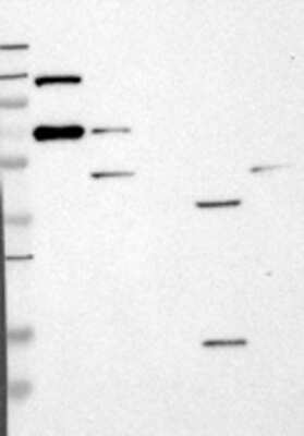 Western Blot: CC2D1A Antibody [22310002] - Samples:  Lane 1, Marker [kDa]: 250, 130, 95, 72, 55, 36, 28, 17, 11  Lane 2, RT-4  Lane 3, U-251MG sp  Lane 4, Human Plasma  Lane 5, Liver  Lane 6, Tonsil ,  Target weight [kDa]:  104, 64, 40, 25 (splice variants)  Validation score:  2   Validation description:  Supportive - Band of predicted size in kDa (+/-20%) with additional bands present.