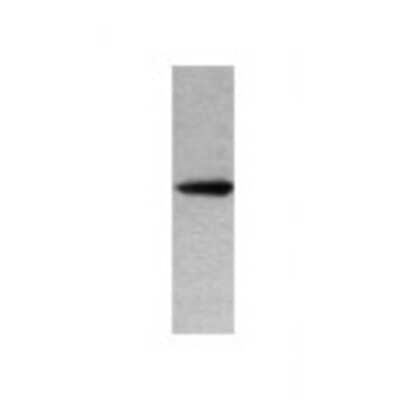 Western Blot: Lipin 2 Antibody [22420002] - Western Blot was performed using affinity purified SEQer LPIN2 antibody, aa(351-450) antibody. The lanes contain 5-30ug of a whole cell extract.  Final concentration of antibodies = 0.1ug/ml (1:10,000 dilution). The blot was probed overnight with the SEQer LPIN2 antibody, aa(351-450) antibody.  Blot was then washed according to protocol and probed with goat-anti-Rabbit-HRP conjugate at 1:5000 dilution, washed and developed using chemiluminescence (film exposure 5-30sec).  The protein was detected as represented by the band shown.