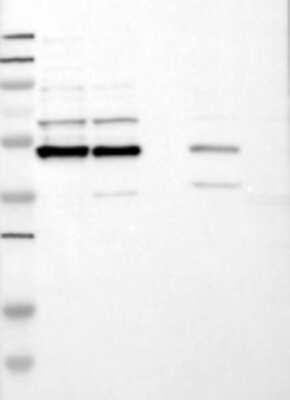 Western Blot: DEK Antibody [22480002] - Samples:  Lane 1, Marker [kDa]: 250, 130, 95, 72, 55, 36, 28, 17, 11  Lane 2, RT-4 Lane 3, U-251MG sp Lane 4, Human Plasma Lane 5, Liver Lane 6, Tonsil      Target weight [kDa]:  48, 43 (splice variants)       Validation score:  2   Validation description:  Supportive - Band of predicted size in kDa (+/-20%) with additional bands present. 