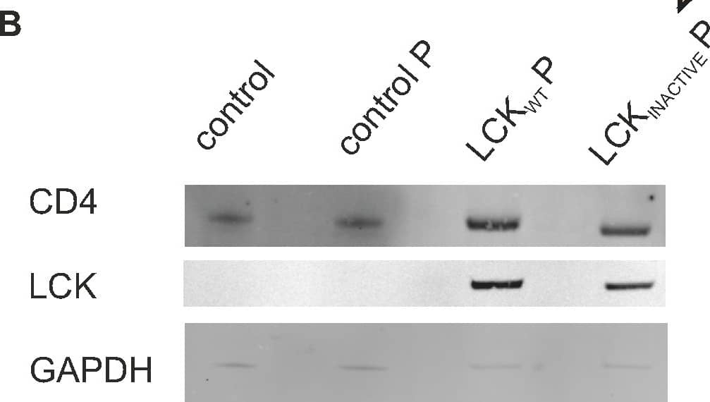 Higher levels of CD4 are found in macrophages expressing LCK.A) Schematic diagram of self-inactivating lentiviral construct used to express wild-type Lck and puroR (LCKWT P). A similar construct was used to express a kinase inactive form of Lck and puroR (LCKINACTIVE P) or to express puroR only (‘control P’). B) Detection of protein expression of LCK and CD4. Control and transgenic PSC-macrophages lysates were analysed by western blotting using anti-LCK and anti-CD4 antibodies. The loading control GAPDH was detected using anti-GAPDH antibody. C) Protein levels were measured with Odyssey software (Li-COR) and CD4 expression was normalised to GAPDH expression. Symbols represent normalised CD4 expression, relative to the PSC-macrophages control group, of two independent experiments. D) Detection of surface CD4 and total LCK expression. Representative two-colour immunofluorescence (dot plot) analysis is shown. Gates were determined by using the two relevant isotype control antibodies. Quantification of total LCK expression (E) and surface CD4 expression (F), expressed as the ratio of the geometric mean fluorescence intensity (MFI) over the isotype control ±SEM of independent experiments (n = 7). G) Detergent resistance of CD4, expressed as mean Flow Cytometric Detergent Resistance (FCDR) index of CD4 (n = 4) in PSC-macrophages, calculated as described in materials and methods. Image collected and cropped by CiteAb from the following open publication (//pubmed.ncbi.nlm.nih.gov/24465876), licensed under a CC-BY license. Not internally tested by R&D Systems.