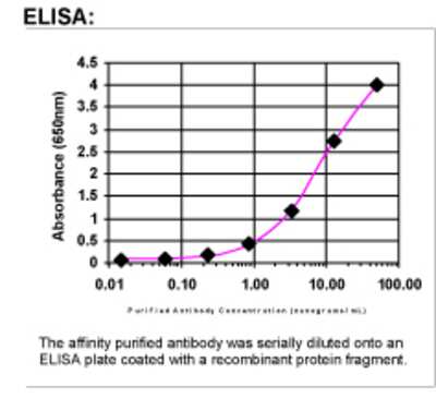 ELISA: Von Hippel Lindau Antibody [23190002]