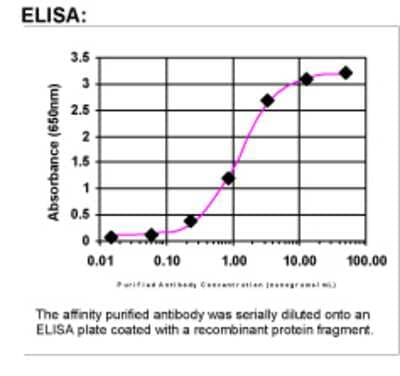 ELISA: Cathepsin V Antibody [23400002]