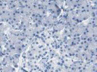 Immunohistochemistry: Decorin Antibody [23540002] - Immunohistochemical staining for decorin (DCN) in   Exocrine glandular and islet cells of normal human pancreas stained negative.  Several pancreas cancers and occasional cases of other malignancies showed strong cytoplasmic staining.  These images are the courtesy of the Human Proteome Resource (HPR).