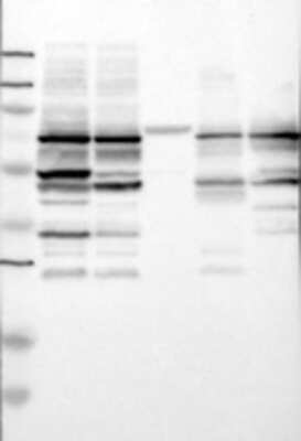 Western Blot: c-Myb Antibody [23950002] - Samples: Lane 1: Marker [kDa]: 250, 130, 95, 72, 55, 36, 28, 17, 11 / Lane 2: RT-4 / Lane 3: U-251MG sp / Lane 4: Human Plasma / Lane 5: Liver / Lane 6: Tonsil; Target weight [kDa]: 85, 82, 76, 72, 41, 31 (splice variants)