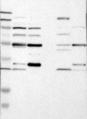 Western Blot: AAMP Antibody [24430002] - Samples:  Lane 1, Marker [kDa]: 250, 130, 95, 72, 55, 36, 28, 17, 11  Lane 2, RT-4 Lane 3, U-251MG sp  Lane 4, Human Plasma  Lane 5, Liver Lane 6, Tonsil, Target weight [kDa]: 47 Validation score: 2 