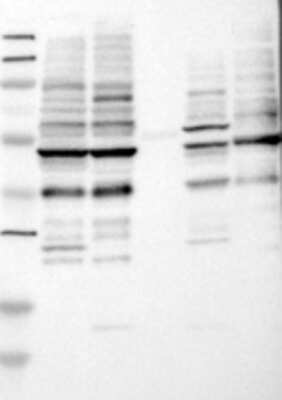Western Blot: ING1 Antibody [24640002] - Samples:  Lane 1, Marker [kDa]: 250, 130, 95, 72, 55, 36, 28, 17, 11  Lane 2, RT-4 Lane 3, U-251MG sp  Lane 4, Human Plasma  Lane 5, Liver  Lane 6, Tonsil,  Target weight [kDa]:  47, 32, 27, 24 (splice variants)    Validation score:  2   Validation description: Supportive - Band of predicted size in kDa (+/-20%) with additional bands present.