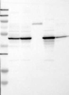 Western Blot: Fumarase Antibody [24880002] - Samples:  Lane 1, Marker [kDa]: 250, 130, 95, 72, 55, 36, 28, 17, 11  Lane 2, RT-4 Lane 3, U-251MG sp Lane 4, Human Plasma Lane 5, Liver Lane 6, Tonsil      Target weight [kDa]:  55       Validation score:  2   Validation description:  Supportive - Band of predicted size in kDa (+/-20%) with additional bands present. 