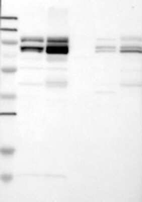 Western Blot: CUL4B Antibody [25150002] - Samples:  Lane 1, Marker [kDa]: 250, 130, 95, 72, 55, 36, 28, 17, 11  Lane 2, RT-4  Lane 3, U-251MG sp  Lane 4, Human Plasma  Lane 5, Liver  Lane 6, Tonsil , Target weight [kDa]:  104, 103, 102 (splice variants)   Validation score:  2   Validation description:  Supportive - Band of predicted size in kDa (+/-20%) with additional bands present.