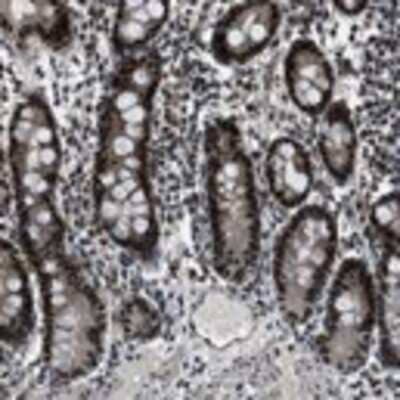 Immunohistochemistry: TLX3 Antibody [25280002] - Normal and malignant tissues showed moderate to strong nuclear cytoplasmic staining. Gastro-intestinal glandular cells, urothelial cells, cells of seminiferus duct and tonsil exhibited strong nuclear and cytoplasmic staining. Placenta and exocrine pancreas displayed strong nuclear staining. Malignancies displayed in most cases similar staining as the corresponding normal tissue.  Image and statement courtesy of the Human Protein Atlas (HPA).