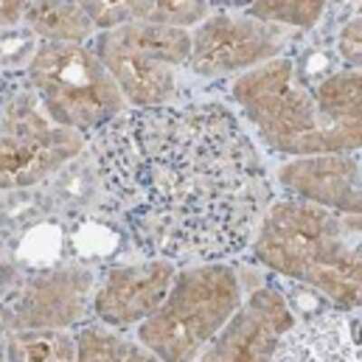 Immunohistochemistry: NAD Synthetase Antibody [25420002] - Most of the normal tissues displayed weak to moderate cytoplasmic positivity. Neuronal cells in the CNS showed moderate nuclear membrane staining. Squamous epithelia, breast and prostate glands were mainly negative. A few cases of gliomas, melanomas and urothelial cancers exhibited weak to moderate cytoplasmic immunoreactivity. The remaining tumors were basically negative.  Image and statement courtesy of the Human Protein Atlas (HPA).