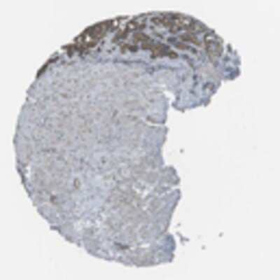Immunohistochemistry: CLNS1A Antibody [26570002] - Moderate cytoplasmic and occasional membranous positivity was observed in most normal tissues. Muscle, cells of CNS except Purkinje cells and lymphoid tissues were negative. Malignant tissues displayed in most cases staining patterns similar to the corresponding normal tissue.  Image and statement courtesy of the Human Protein Atlas (HPA).
