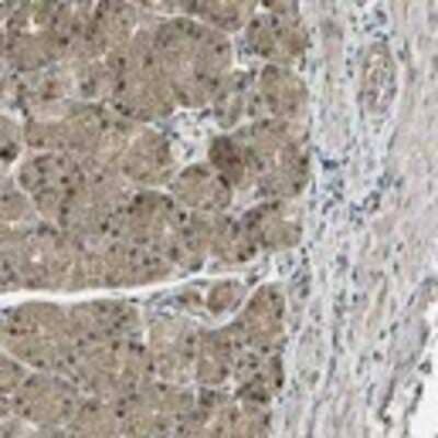 Immunohistochemistry: DLEU1 Antibody [26660002] - Weak to moderate cytoplasmic and nuclear positivity was seen in most normal tissues. Cells of cervix,uterine and spleen were negative. A similar staining pattern was also seen in most malignant tissues, weak to moderate cytoplasmic and occasional nuclear positivity.  Image and statement courtesy of the Human Protein Atlas (HPA).