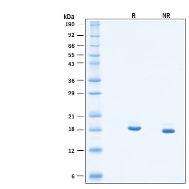 2 μg/lane of Recombinant Mouse PGLYRP1/PGRP-S His-tag Protein (Catalog # 2696-PGB) was resolved with SDS-PAGE under reducing (R) and non-reducing (NR) conditions and visualized by Coomassie® Blue staining, showing bands at 18-21 kDa.