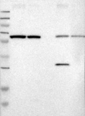 Western Blot: Ribophorin II Antibody [27500002] - Samples:  Lane 1, Marker [kDa]: 250, 130, 95, 72, 55, 36, 28, 17, 11  Lane 2, RT-4  Lane 3, U-251MG sp  Lane 4, Human Plasma  Lane 5, Liver  Lane 6, Tonsil ,  Target weight [kDa]:   74, 71, 69, 68, 56, 33, 30 (splice variants)    Validation score:   2   Validation description:   Supportive - Band of predicted size in kDa (+/-20%) with additional bands present. 