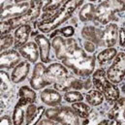 Immunohistochemistry: AKAP1 Antibody [27850002] - Most normal tissues and malignant tissues showed strong cytoplasmic immunoreactivity. Decidual cells in placenta were moderately stained. Bile ducts, renal glomeruli and stromal cells along with some of the malignant lymphomas and renal cancers were weakly stained or negative.  Image and statement courtesy of the Human Protein Atlas (HPA).