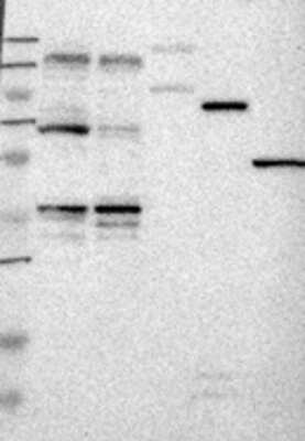 Western Blot: LIM kinase 2 Antibody [28670002] - Samples: Lane 1, Marker [kDa]: 250, 130, 95, 72, 55, 36, 28, 17, 11  Lane 2, RT-4  Lane 3, U-251MG sp  Lane 4, Human Plasma  Lane 5, Liver  Lane 6, Tonsil ,  Target weight [kDa]:   78, 72, 71, 70 (splice variants)   Validation score:  2   Validation description:   Supportive - Band of predicted size in kDa (+/-20%) with additional bands present.