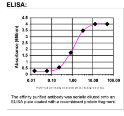 ELISA: CYP1B1 Antibody [28760002]