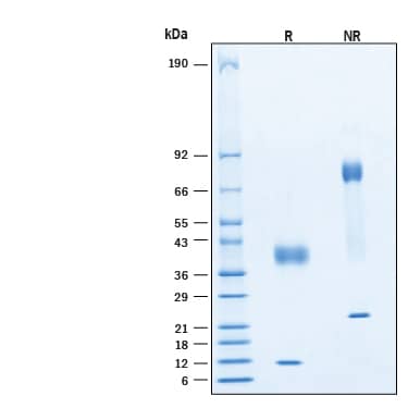 2 μg/lane of Recombinant Human Latent TGF‑ beta 1 Protein (Catalog # 299-LTB) was resolved with SDS-PAGE under reducing (R) and non-reducing (NR) conditions and visualized by Coomassie® Blue staining, showing bands at 36-42 kDa & 9-13 kDa, and 70-80 kDa and 18-26 kDa, respectively.