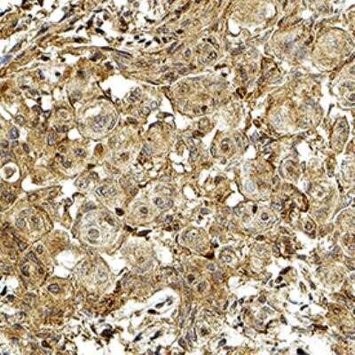 Immunohistochemistry-Paraffin: 3-OHKYN Antibody (P3UI) - Azide and BSA Free [NBP2-80548] - 3-OHKYN was detected in immersion fixed paraffin-embedded sections of human brain using Mouse Anti-Human 3-OHKYN (P3UI) Monoclonal Antibody (Catalog # NB100-597) at 1:300 for 1 hour at room temperature followed by incubation with the Anti-Mouse IgG VisUCy