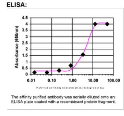 ELISA: ANKRD6 Antibody [30150002]