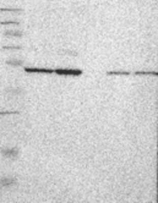 Western Blot: ARHGAP22 Antibody [30180002] - Samples:  Lane 1, Marker [kDa]: 250, 130, 95, 72, 55, 36, 28, 17, 11  Lane 2, RT-4 Lane 3, U-251MG sp  Lane 4, Human Plasma  Lane 5, Liver  Lane 6, Tonsil ,  Target weight [kDa]:  77, 64, 59 (splice variants)   Validation score:  1   Validation description:  Supportive - Single band corresponding to the predicted size in kDa (+/-20%).