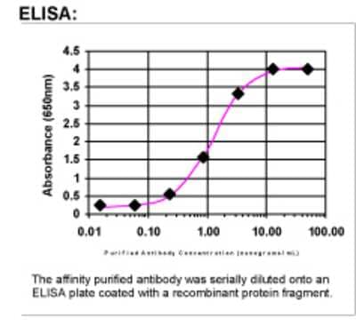 ELISA: TNIP2 Antibody [30820002]