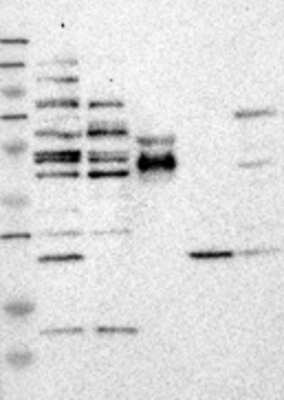 Western Blot: STAU2 Antibody [30890002] - Samples: Lane 1: Marker [kDa]: 250, 130, 95, 72, 55, 36, 28, 17, 11 / Lane 2: RT-4 / Lane 3: U-251MG sp / Lane 4: Human Plasma / Lane 5: Liver / Lane 6: Tonsil; Target weight [kDa]: 63, 53 (splice variants)