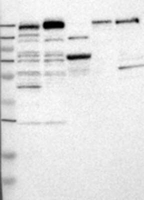 Western Blot: MYO5C Antibody [32190002] - Samples:  Lane 1, Marker [kDa]: 250, 130, 95, 72, 55, 36, 28, 17, 11  Lane 2, RT-4  Lane 3, U-251MG sp  Lane 4, Human Plasma  Lane 5, Liver  Lane 6, Tonsil ,  Target weight [kDa]:   203        Validation score:  2   Validation description:  Supportive - Band of predicted size in kDa (+/-20%) with additional bands present.
