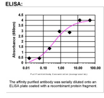 ELISA: Factor XIIIa Antibody [33190002]