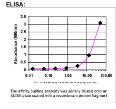ELISA: S100B Antibody [34690002]