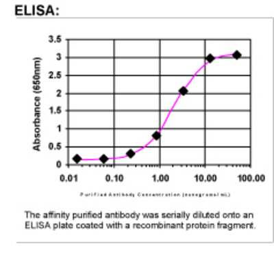 ELISA: Bad Antibody [35060002]