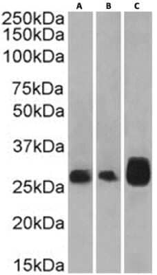 Western Blot: 4-1BB/TNFRSF9/CD137 Antibody (4B4-1-1) - Chimeric [NBP3-12029] - Human thymus(A), lymph node(B) and tonsil(C) tissue lysate (35ug protein in RIPA buffer) was resolved on a SDS PAGE gel and blots were probed with the chimeric rabbit version of 4B4-1-1 (NBP3-12029) at 0.3 ug/ml before detection using an anti-rabbit secondary antibody. A primary incubation of 1h was used and protein was detected by chemiluminescence.