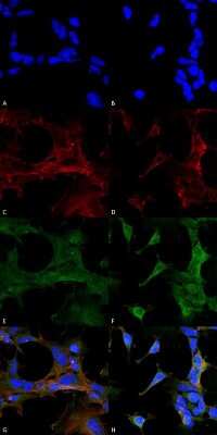 Immunocytochemistry/Immunofluorescence: 4-Hydroxy-2-hexenal Antibody (6F10) [NBP2-59352] - Immunocytochemistry/Immunofluorescence analysis using Mouse Anti-4-Hydroxy-2-hexenal Monoclonal Antibody, Clone 6F10 (NBP2-59352). Tissue: Embryonic kidney epithelial cell line (HEK293). Species: Human. Fixation: 5% Formaldehyde for 5 min. Primary Antibody: Mouse Anti-4-Hydroxy-2-hexenal Monoclonal Antibody (NBP2-59352) at 1:400 for 30-60 min at RT. Secondary Antibody: Goat Anti-Mouse Alexa Fluor 488 at 1:1500 for 30-60 min at RT. Counterstain: Phalloidin Alexa Fluor 633 F-Actin stain; DAPI (blue) nuclear stain at 1:250, 1:50000 for 30-60 min at RT. Magnification: 20X (2X Zoom). (A,C,E,G) - Untreated. (B,D,F,H) - Cells cultured overnight with 50 M H2O2. (A,B) DAPI (blue) nuclear stain. (C,D) Phalloidin Alexa Fluor 633 F-Actin stain. (E,F) 4-Hydroxy-2-hexenal Antibody. (G,H) Composite. Courtesy of: Dr. Robert Burke, University of Victoria.