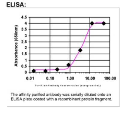 ELISA: BRCA1 Antibody [40920002]