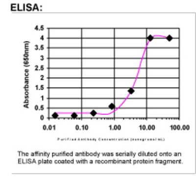 ELISA: BRCA1 Antibody [40930002]