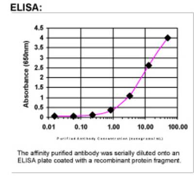 ELISA: BRCA1 Antibody [40950002]